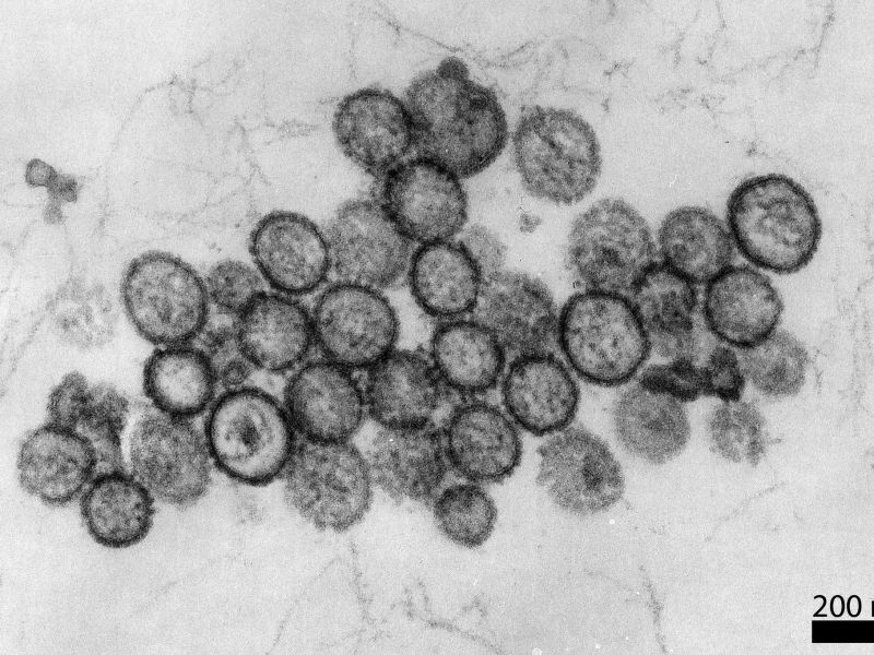Hantavirus auf der "MV Hondius": Mehrere Tote auf Kreuzfahrtschiff nach Infektion mit Nagervirus