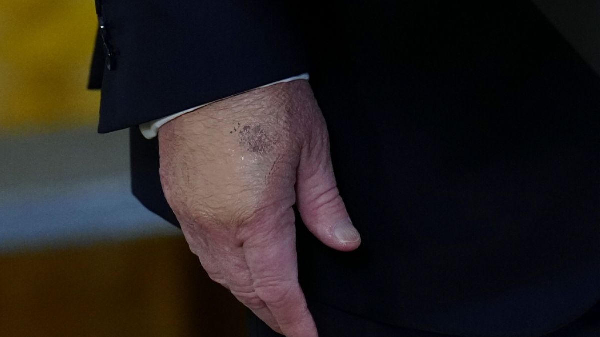 An dieser Stelle "entbl&ouml;&szlig;te" die First Lady ihren Mann, indem sie das Make-Up verwischte. (Foto)