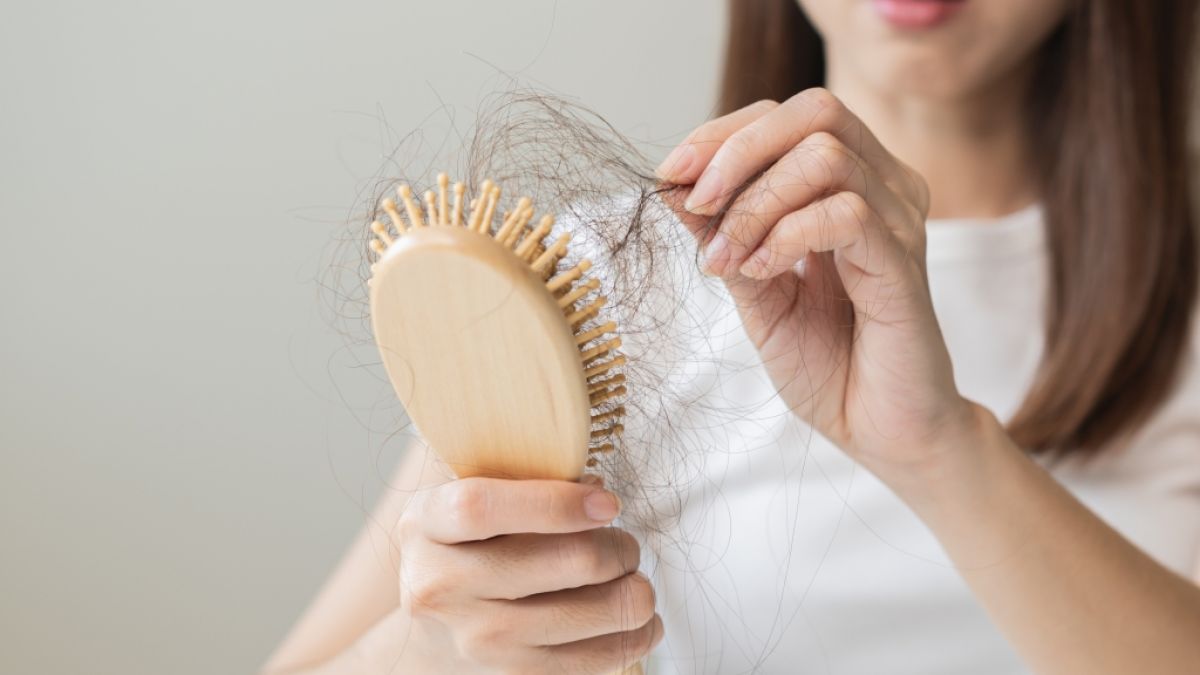 In Deutschland leben rund 1,5 Millionen Menschen mit der Diagnose kreisrunder Haarausfall, auch Alopecia areata genannt. (Foto)