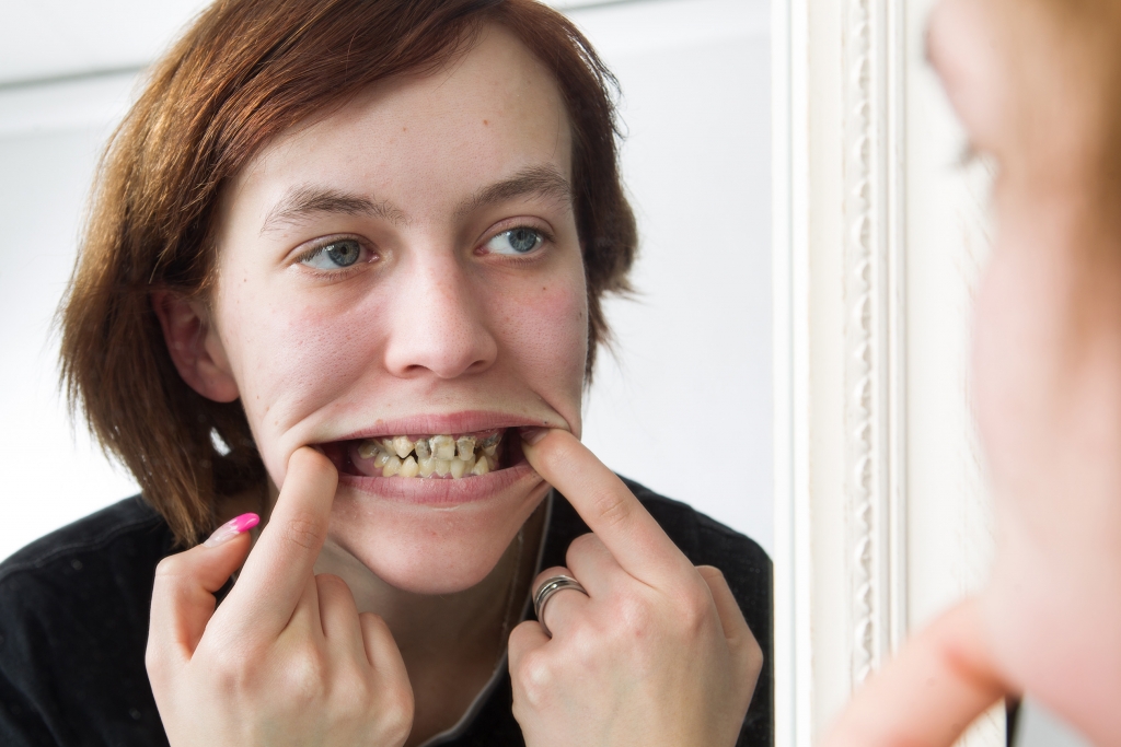 20 schlechte zähne mit Wie behandelt