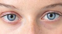 Eine Infektion mit den neuartigen Coronaviren kann den Augen schaden (Symbolfoto).