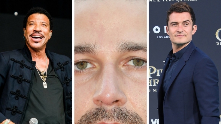 Lionel Richie, Shia LaBeouf und Orlando Bloom zählen zu unseren Promi-Verlierern der Woche.