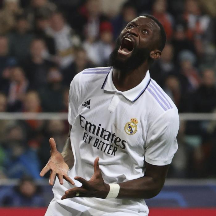 Horror-Verletzung! Real-Madrid-Star kann Auge nicht öffnen
