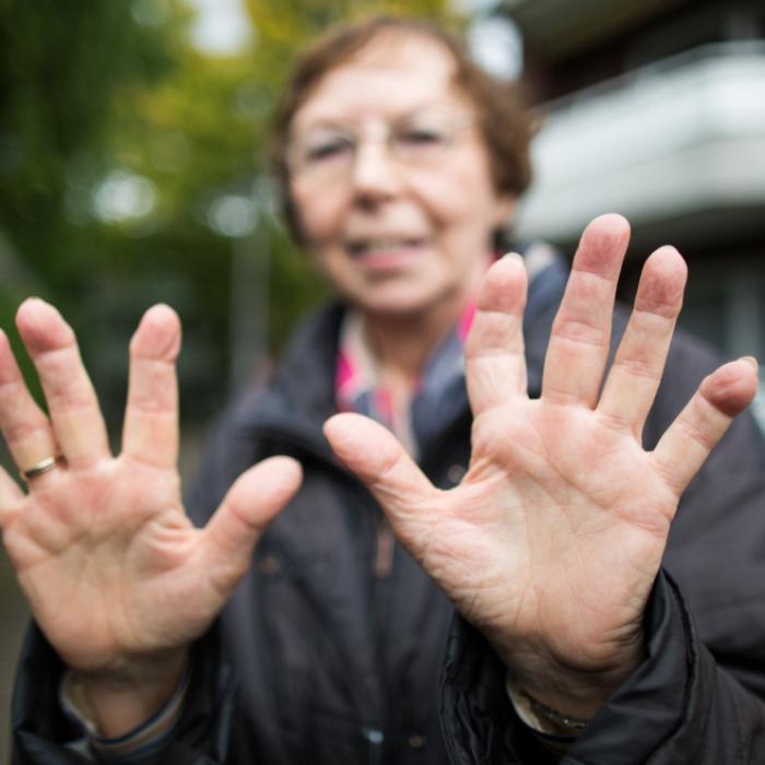 Abnehmspritzen können laut Forschern für Osteoporose sorgen