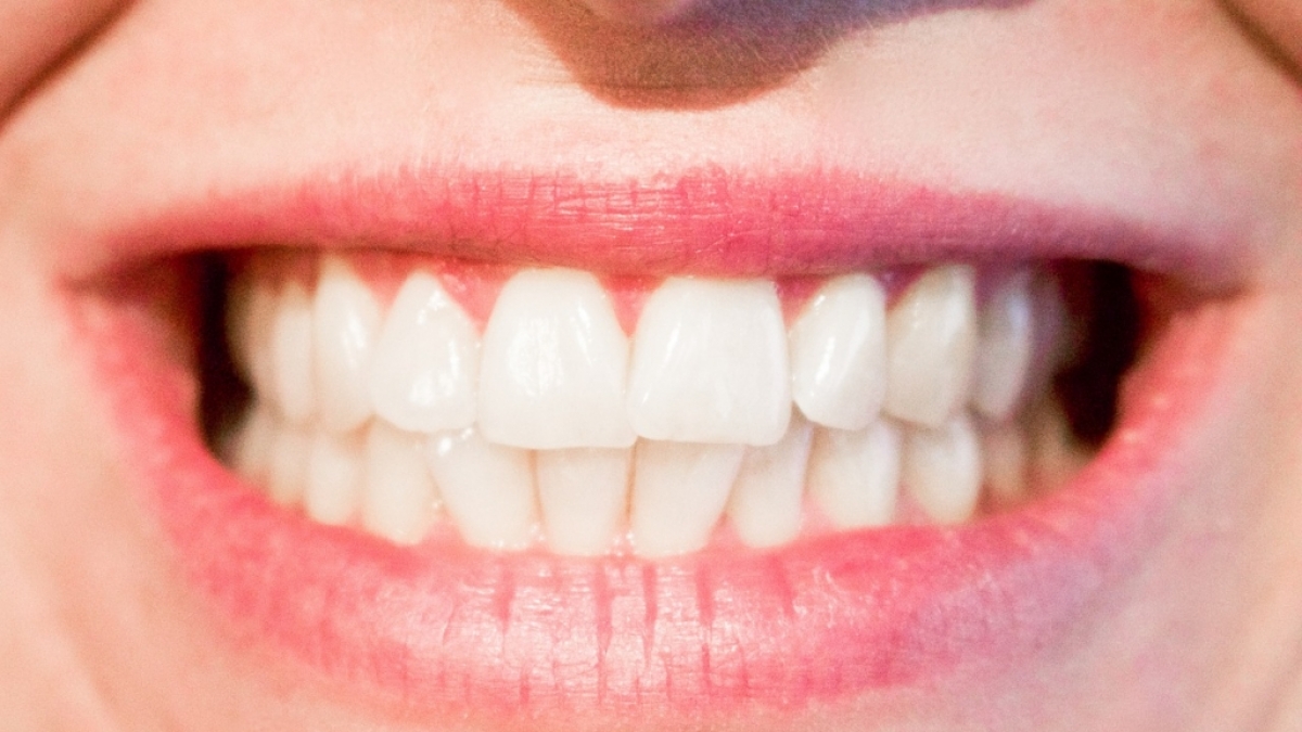 F&uuml;r ein strahlend wei&szlig;es L&auml;cheln muss man nicht zwangsl&auml;ufig zum Bleaching greifen - auch altbew&auml;hrte Anwendungen verhelfen zum Hollywood-Strahlen. (Foto)