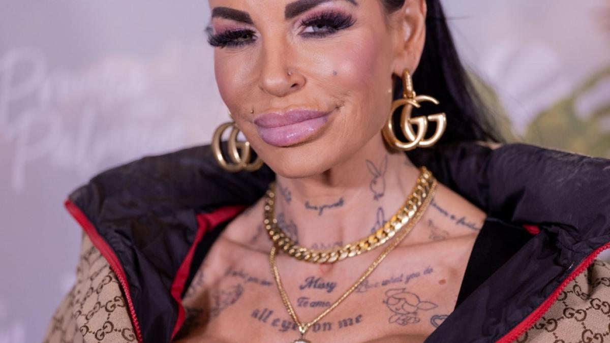 Gina-Lisa Lohfink leidet unter den Folgen einer Sch&ouml;nheitsoperation. (Foto)