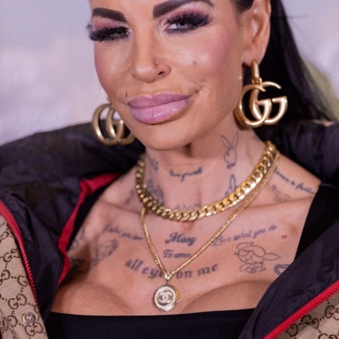 Reality-TV-Star fürchtet wegen offener Wunden um sein Leben