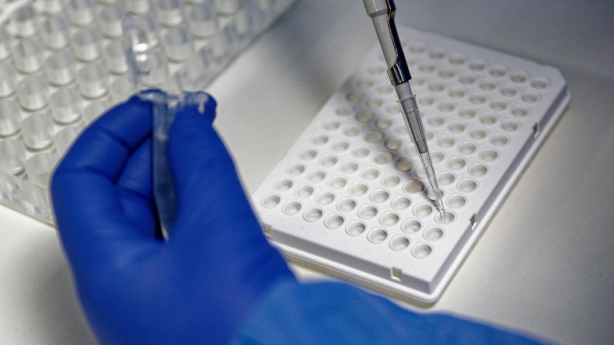 Eine aktuelle Studie des Uniklinikums in Hamburg-Eppendorf zeigt auf, wie viele Menschen tats&auml;chlich an Corona-Infektionen mit dem Omikron-Subtyp sterben. (Foto)