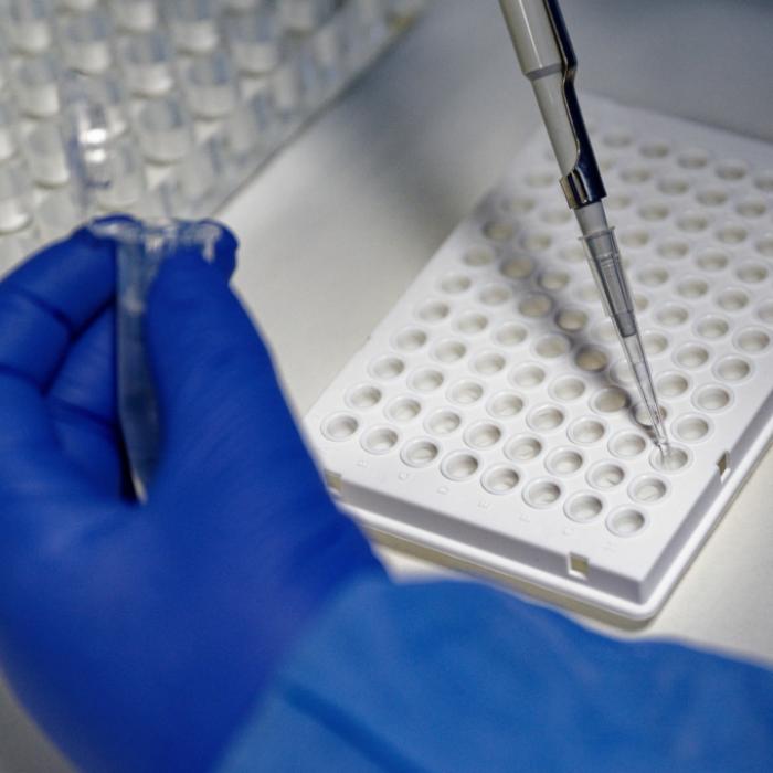 So viele Covid-Patienten sterben tatsächlich an Omikron-Infektionen