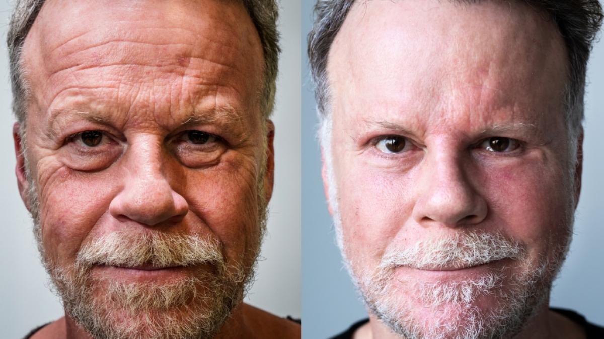 Nach seinem Sch&ouml;nheitsexperiment sieht Extrem-Reporter Jenke von Wilmsdorff jetzt deutlich j&uuml;nger aus. Doch sein neues faltenfreies Gesicht gef&auml;llt nicht jedem. (Foto)
