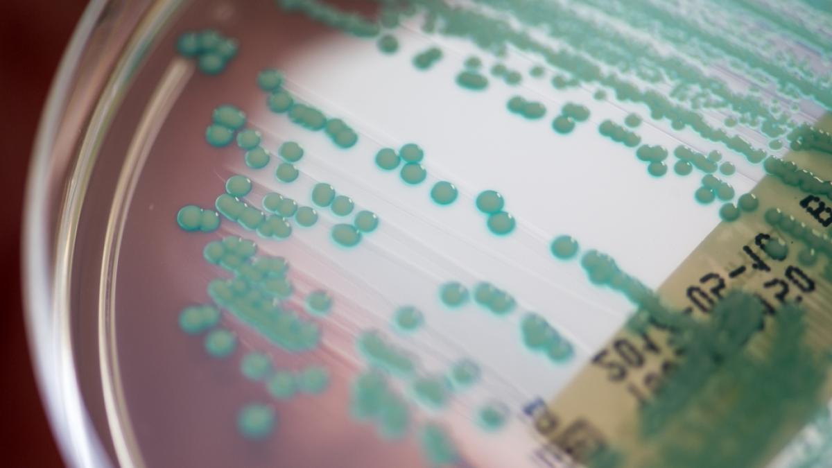 Die globale Ausbreitung multiresistenter Keime l&auml;sst Experten Alarm schlagen. (Foto)