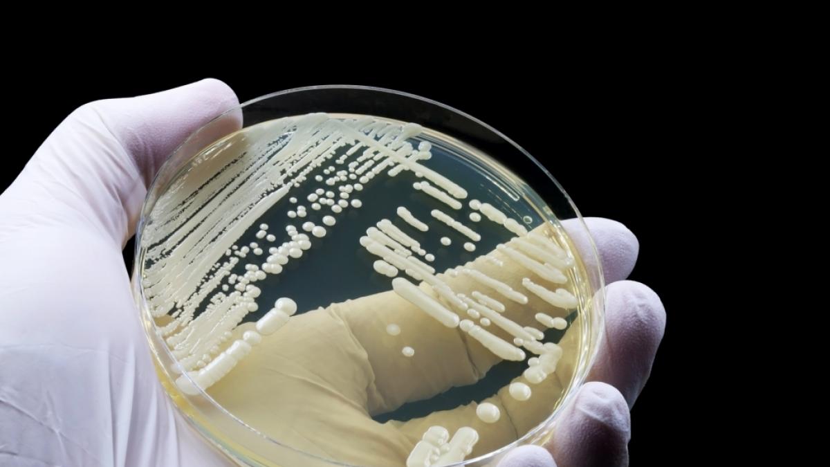 Pilzarten wie Candida auris breiten sich immer mehr aus. (Foto)
