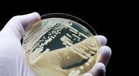Pilzarten wie Candida auris breiten sich immer mehr aus.