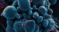 Der erste Fall einer Coronavirus-Infektion in Deutschland wurde am 27. Januar 2020 bestätigt - seitdem sind mehr als 50.000 Menschen durch Covid-19 in der Bundesrepublik gestorben.