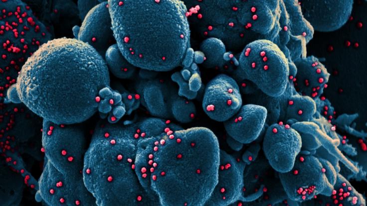 Der erste Fall einer Coronavirus-Infektion in Deutschland wurde am 27. Januar 2020 bestätigt - seitdem sind mehr als 50.000 Menschen durch Covid-19 in der Bundesrepublik gestorben.