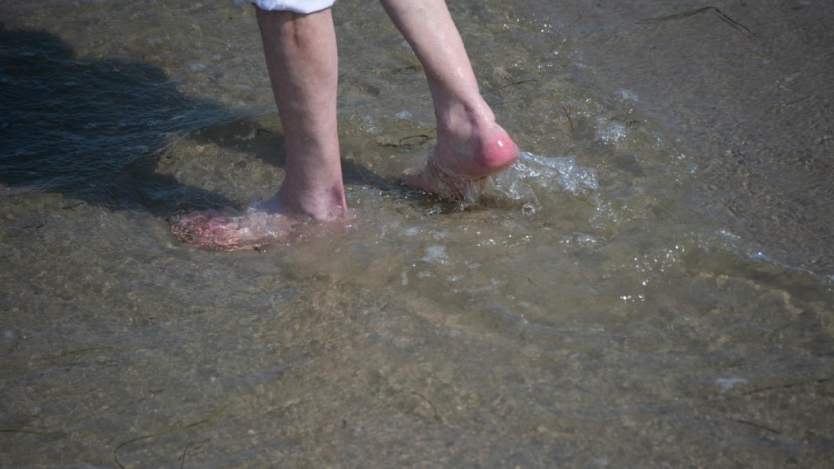 F&uuml;r einen 74-J&auml;hrigen endete ein Bade-Urlaub an der Ostsee t&ouml;dlich, nachdem sich der Senior mit Vibrionen infiziert hatte. (Foto)