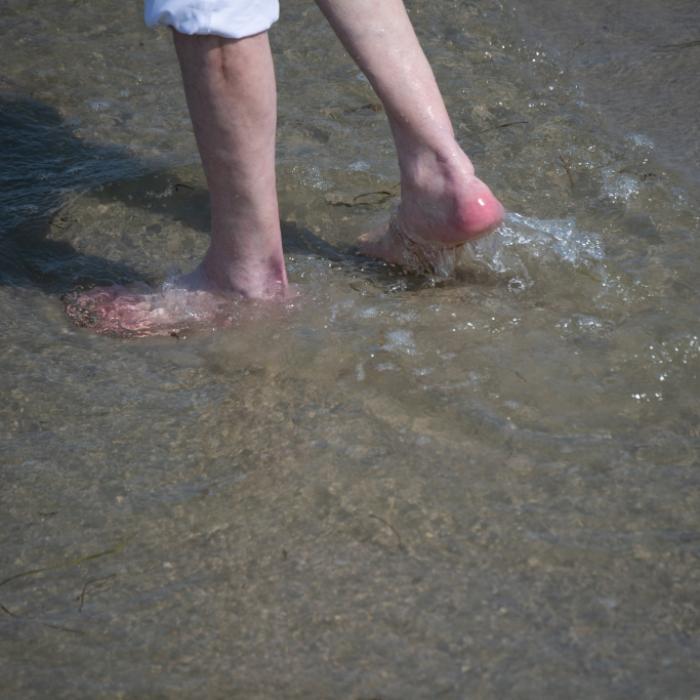 Ostsee-Badeurlauber (74) nach Infektion mit Killer-Bakterien gestorben