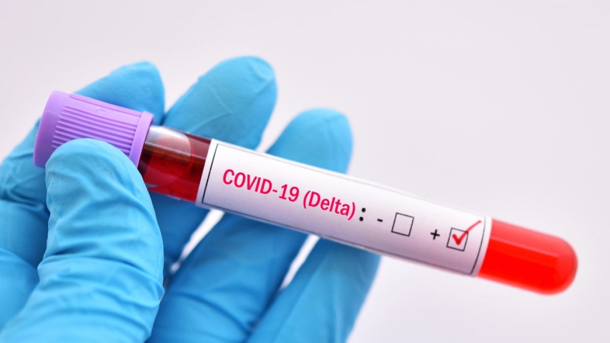 Trotz Impfung starben in Gro&szlig;britannien Menschen an der Delta-Variante des Coronavirus. (Foto)