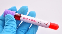 Trotz Impfung starben in Großbritannien Menschen an der Delta-Variante des Coronavirus.