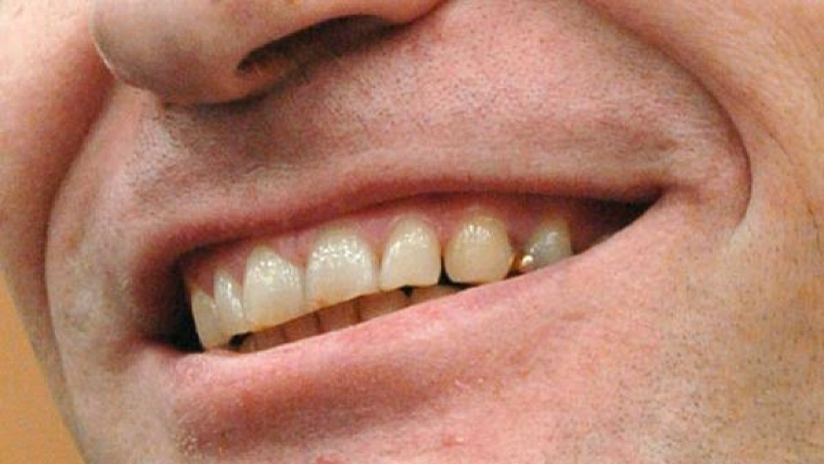 Immer wieder sorgen Fälle von Kannibalismus für Aufsehen. Denn eigentlich verhindert unsere Erbanlage, dass wir andere Menschen als Nahrung betrachten. (Foto)