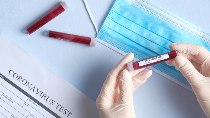 Ist das Coronavirus doch nicht so gefährlich wie angenommen?
