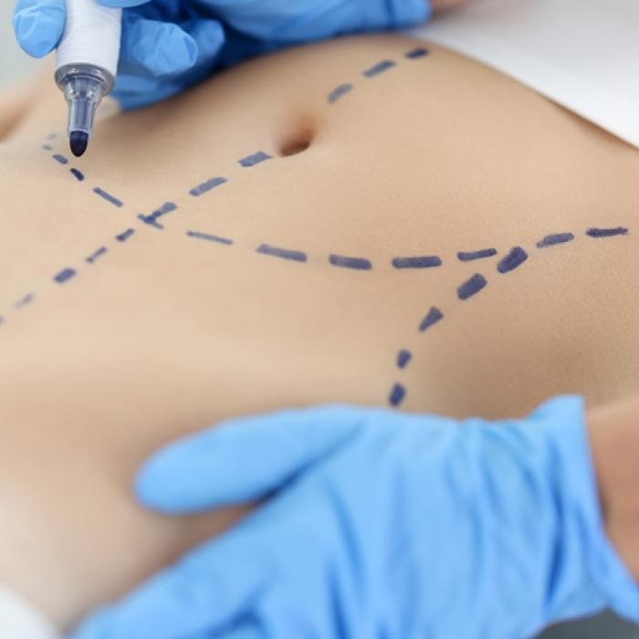 Was leisten sie in der Bauchraummedizin?