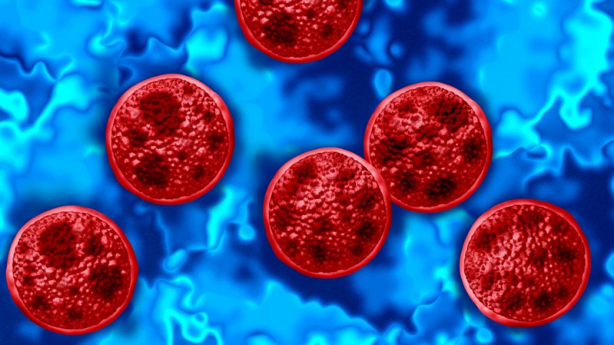 Die amerikanische Gesundheitsbeh&ouml;rde warnt vor der vermehrten Ausbreitung des Parasiten&nbsp;Cyclospora cayetanensis in den USA, vor allem in Michigan. (Foto)