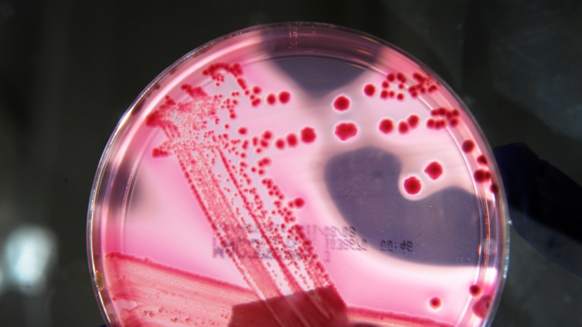 Eine erschreckende Simulation zeigt, wie eine Virus-Pandemie 900 Millionen Menschen t&ouml;ten k&ouml;nnte. (Symbolbild) (Foto)