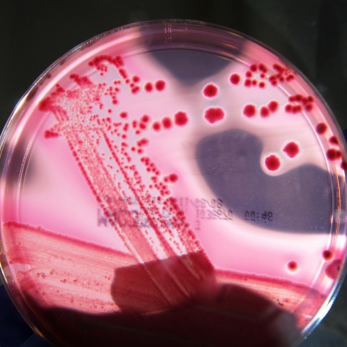 Neuer Killervirus könnte 900 Millionen Menschen töten