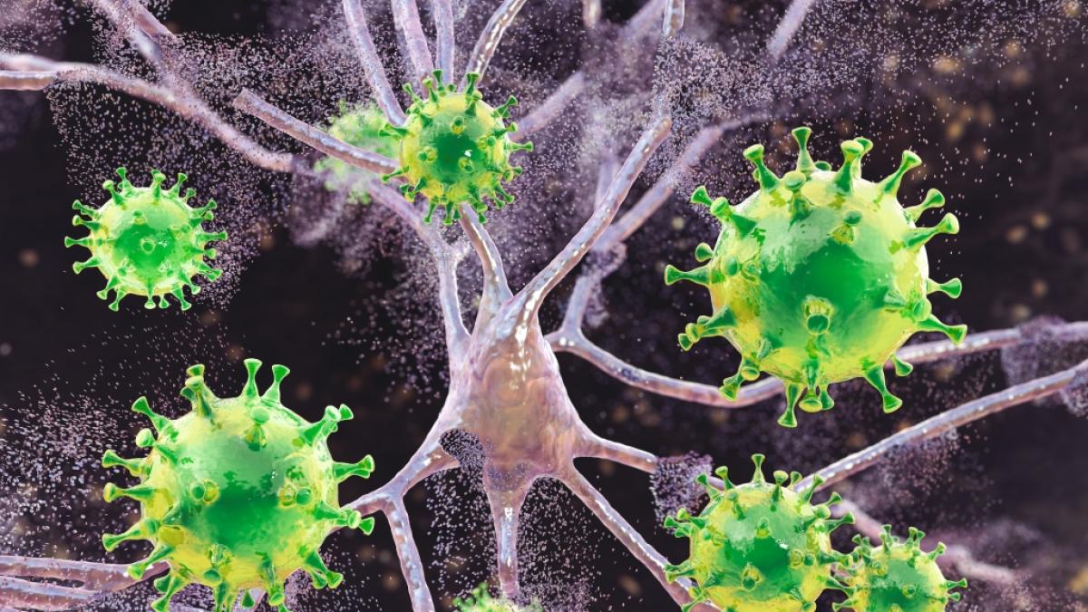 Erh&ouml;ht eine Covid-19-Erkrankung das Alzheimer-Risiko? (Foto)