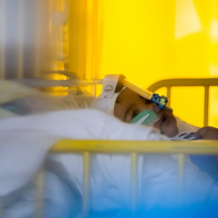 Ein Kleinkind liegt mit einer RSV-Infektion im Krankenhaus. (Symbolbild)