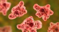 Ein Mann aus Florida starb nach einer Infektion mit Naegleria-fowleri.