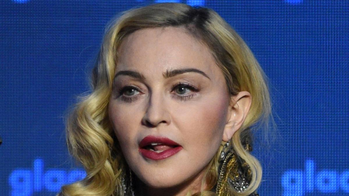 Madonnas v&ouml;llig ver&auml;ndertes Gesicht schockte jetzt zahlreiche Grammy-Awards-Zuschauer. (Foto)