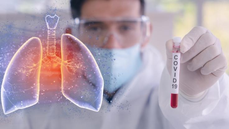 Welche Spätfolgen hat das Coronavirus?