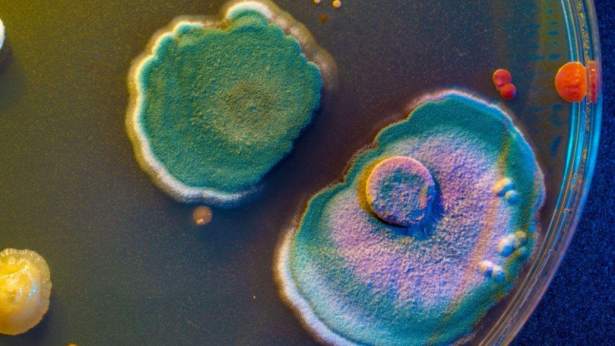 Mediziner:innen blicken mit Sorge auf die Zunahme gef&auml;hrlicher multiresistenter Keime. (Foto)