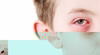 Ein neunjähriger Junge erblindete fast durch das 