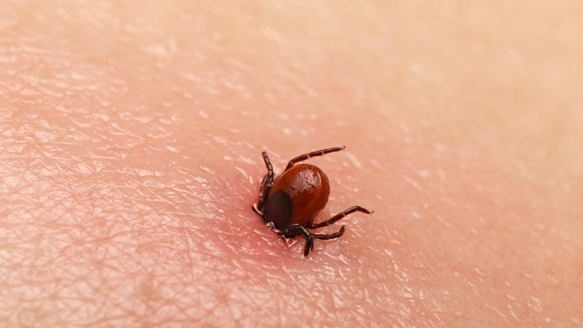 Das Krim-Kongo-Virus wird haupts&auml;chlich durch Zecken auf den Menschen &uuml;bertragen. (Foto)