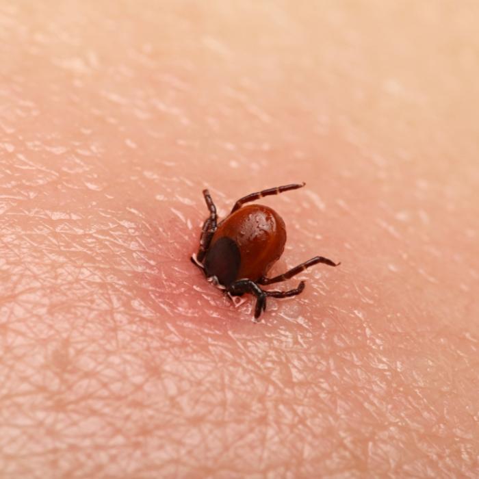 Blut im Auge! Gefährliches Krim-Kongo-Fieber erreicht Spanien
