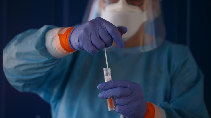 Vor der im Herbst zu erwartenden Grippewelle warnen Gesundheitsexperten vor knappen Coronavirus-Test-Kapazitäten.