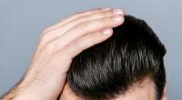 Anti-Schuppen-Shampoos enthalten oft kritische Inhaltsstoffe.
