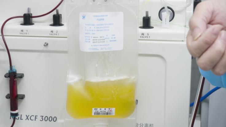 Blutplasma genesener Patienten könnte im Kampf gegen das Coronavirus neue Heilungschancen eröffnen.