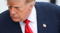 Ein Experte blickt mit Sorge auf den Zustand von Donald Trump (Foto).