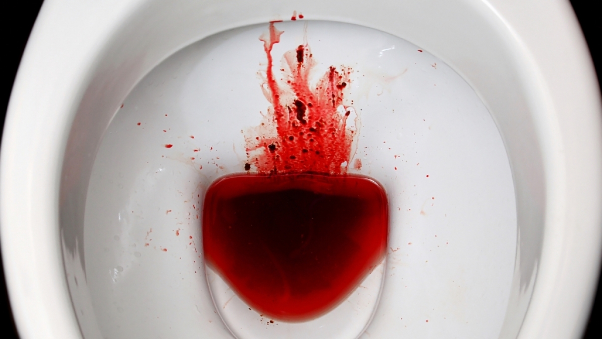 Nadine Lee trinkt ihr eigenes Menstruationsblut, weil sie sich damit angeblich fitter f&uuml;hlt. (Foto)