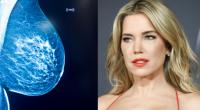 Sylvie Meis macht anderen Frauen im Kampf gegen den Brustkrebs Mut.