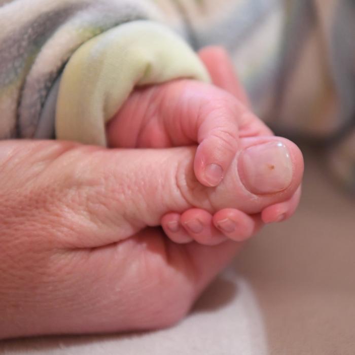 Völlig entstellt! Baby ohne Gesicht auf den Philippinen geboren