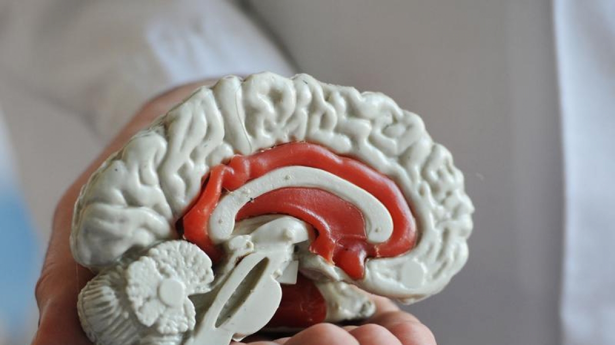 IQ-Test: In welcher Stadt leben die d&uuml;mmsten Deutschen? (Foto)