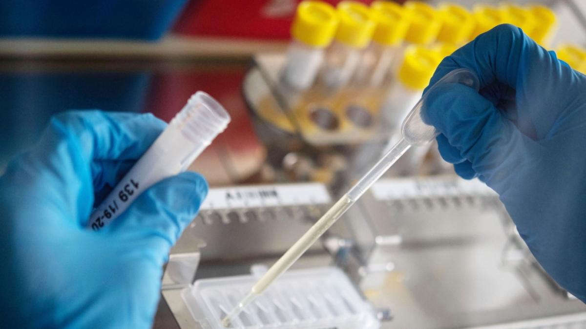 Japanische Forscher haben das Yezo-Virus entdeckt. (Symbolfoto) (Foto)