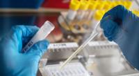 Japanische Forscher haben das Yezo-Virus entdeckt. (Symbolfoto)