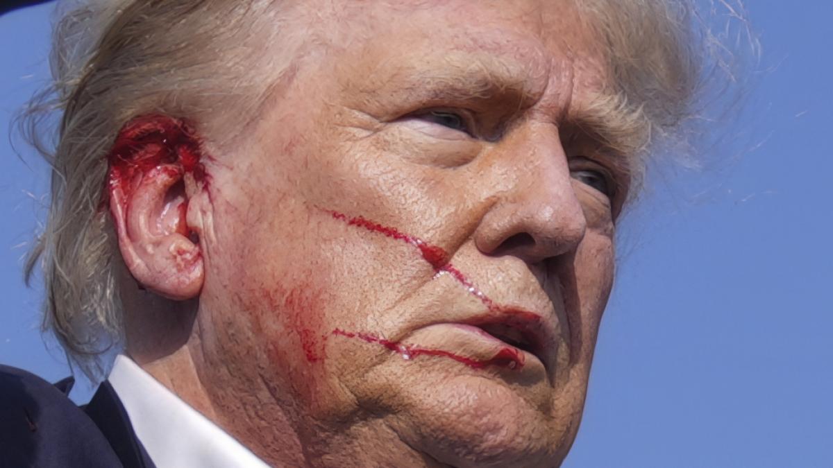 Der Sch&uuml;tze hatte Donald Trump am Ohr verletzt. (Foto)