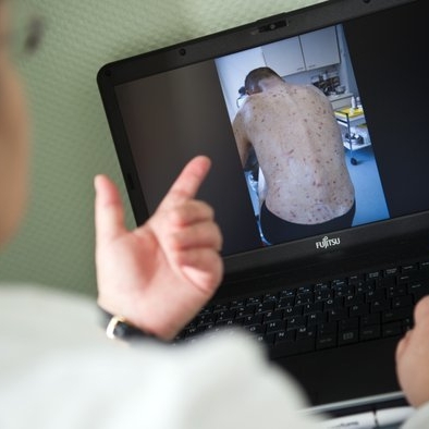 Alles Wichtige über Ansteckung, Übertragung und wirksame Behandlung